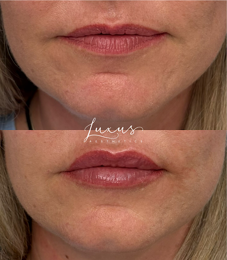 LUXUS Aesthetics + Wellness Colorado