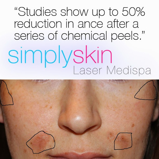 Simply Skin Laser Medispa - Thumbnail