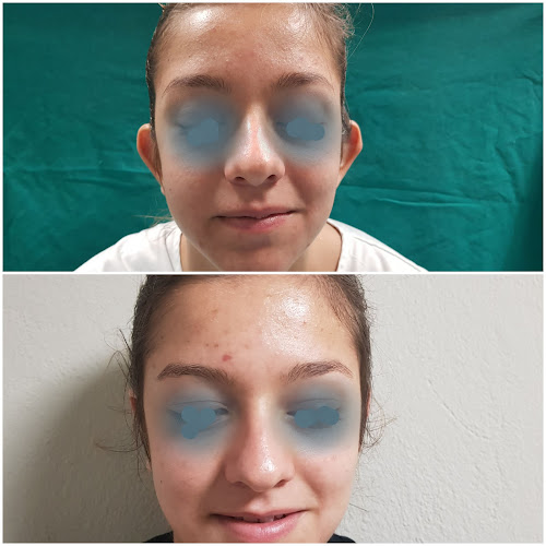 Opinii despre Dr. Θανάσης Παλλαντζάς - Πλαστικός Χειρουργός în Λάρισα - Γιατρός