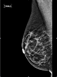 Photo n°9 de Centre d'Imagerie Médicale Le Clipper à Fréjus (Centre d'imagerie pour diagnostic médical)