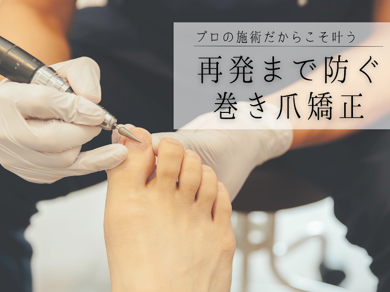 豊橋巻き爪ケア専門院