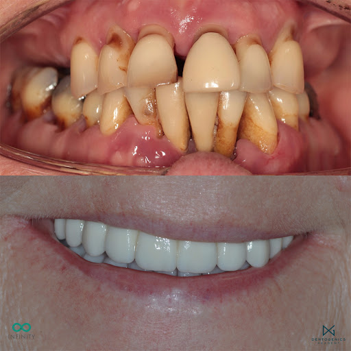 Infinity Dental Clinic - Thumbnail