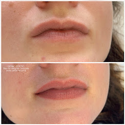 Photo n°12 de Cabinet DERMO ESTETIC à Douvaine (Clinique de maquillage permanent)