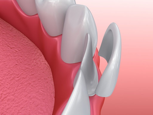 http://www.dentalclinicahmedabad.in/