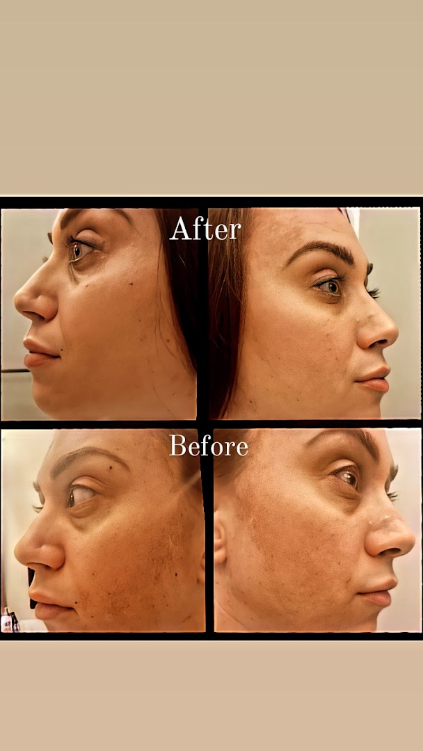 Cavi Med Spa | Body Contouring photo 27