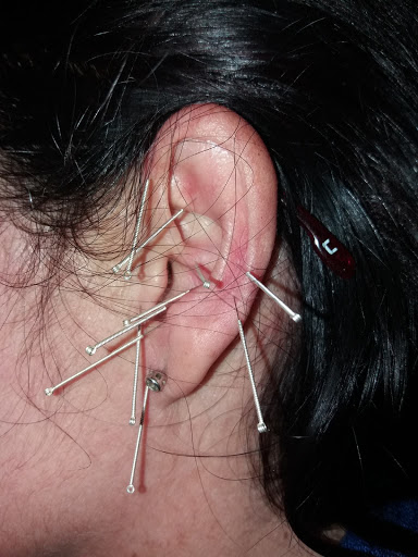 Quiropractico - Tratamientos A Domicilio