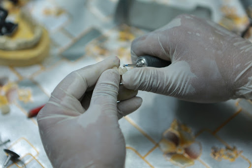 Alpha Veneers Smile Studio