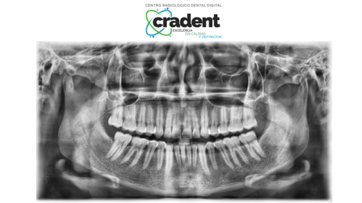 Cradent - Thumbnail