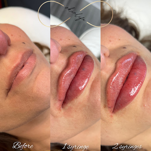 Skin Life Medspa
