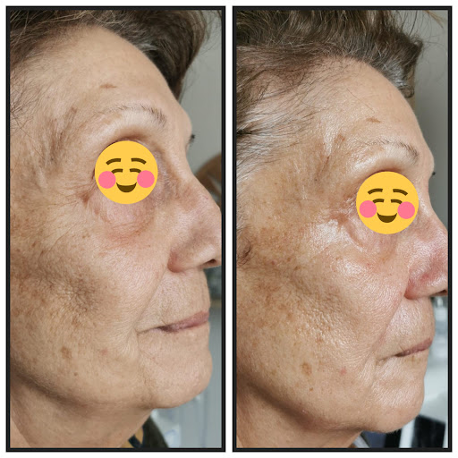 CRYO Dermaconcept - Thumbnail