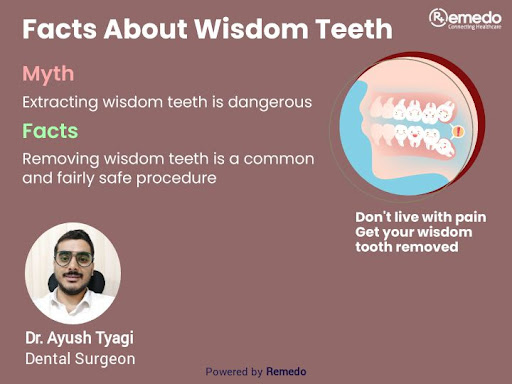 A wisdom tooth is pulled to avoid future complications, like - 