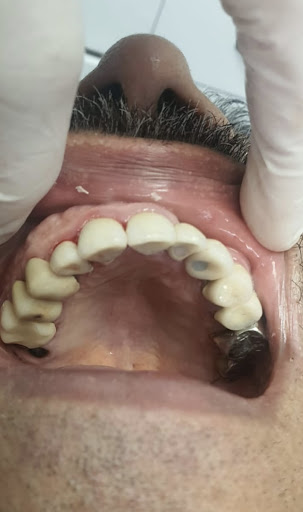 BC Tijuana Clinica Dental Familiar OSONU - Thumbnail