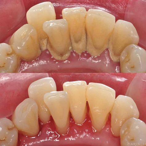 Consultorio odontologico Pacífico Dental - Thumbnail