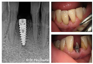 Photo n°8 de Dentiste Argenteuil : Dr. Paul Koskas à Argenteuil (Hygiéniste dentaire)