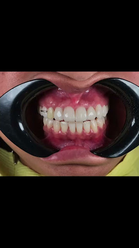 Opiniones de CLINICA DENTAL CEIBOSDENT en Ibarra - Dentista