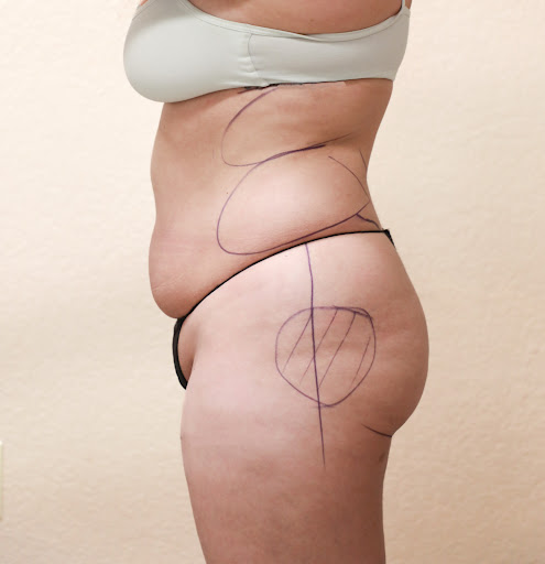 Milk and Honey Body Cosmetic Surgery
