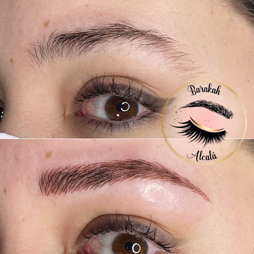 Barakah Alcala centro de estética - Thumbnail