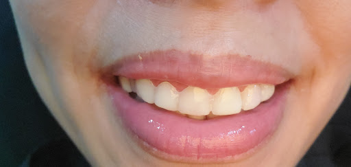 West Coast Dental of Monrovia - Thumbnail