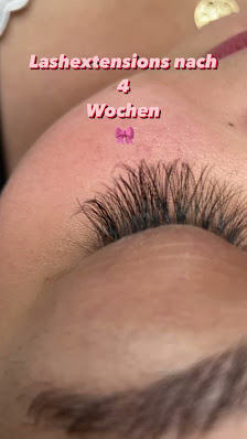 Alle