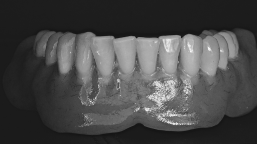 Dental Creation Adelaide