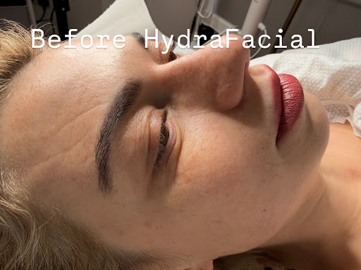 Pheonyx Beauty & Aesthetics