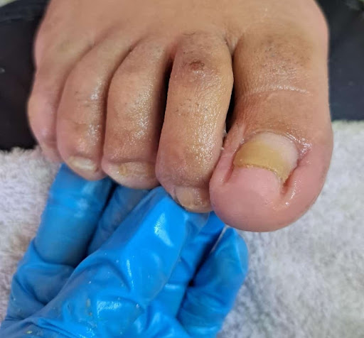 Marquelove - Thumbnail