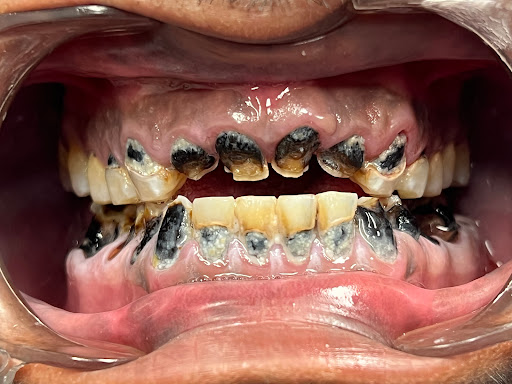 Rockville Dental Arts Gallery - United States