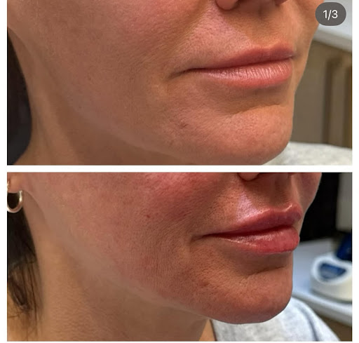 RADIANT a medspa
