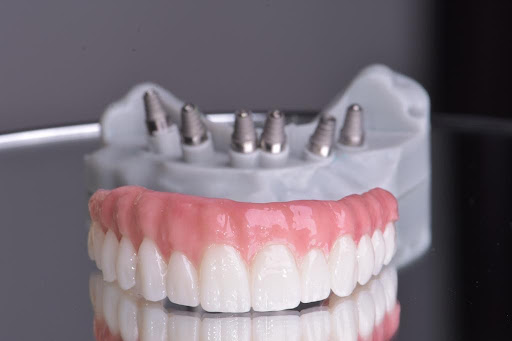 Upper Dental - Visual