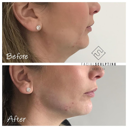 Comments and reviews of Facial Sculpting
