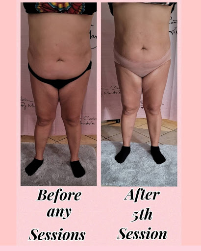 Body Sculpting - Thumbnail