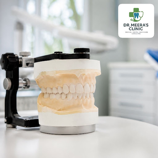 A balanced bite is essential for healthy teeth, jaws, and long-term oral comfort. At Dr. Meera’s… post image