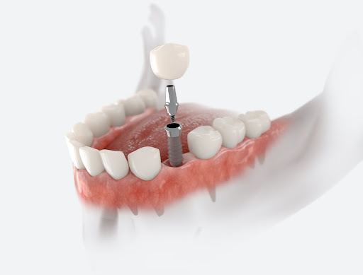 My Bloomingdale Dentist - Thumbnail