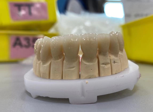 South Shore Dental Laboratory Gallery - United States