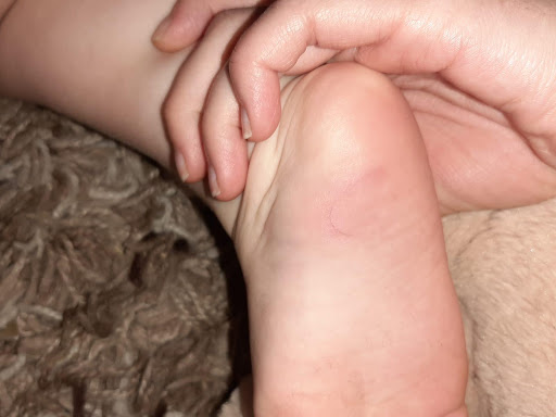 Tameside Foot Clinic - Thumbnail