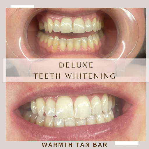 Warmth Spray Tan and Beauty Bar