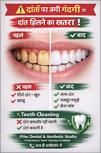 Dental cleaning Starting from just Rs 1000 post image