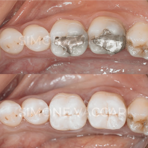 Studio Dentistico Simone Vaccari - Thumbnail