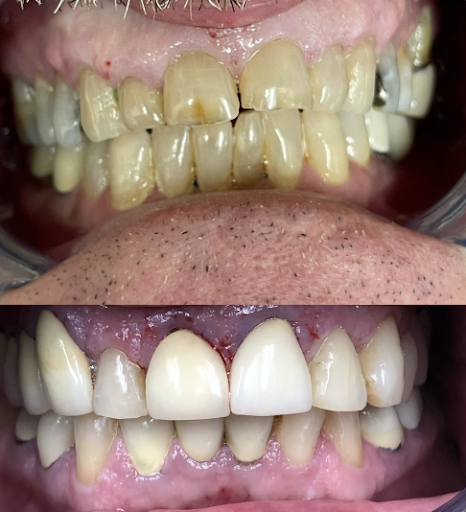 Commack Family Dental