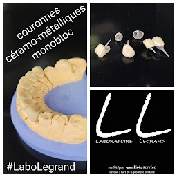 Photo n°35 de Laboratoire Legrand à Verneuil d'Avre et d'Iton (Centre de prothèses dentaires)