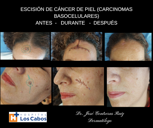 Dr. José Contreras Ruiz. Dermatólogo en Los Cabos - Thumbnail