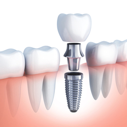 Madison Family Dental Associates - Thumbnail