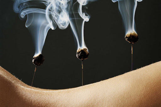 Naturally Appointed Acupuncture and Holistic Wellness Clinic Gallery - United States