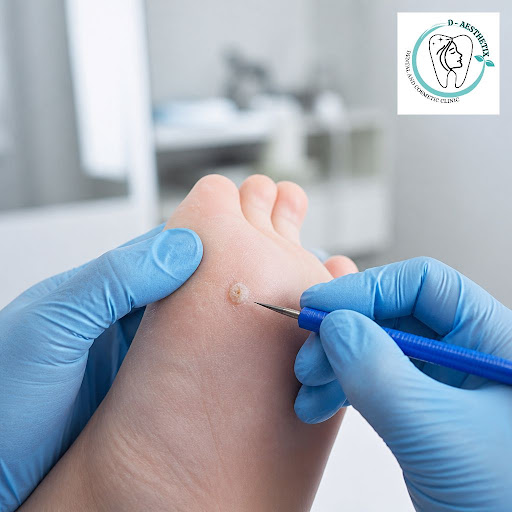 Worried about a stubborn wart and searching for a trusted dermatologist near you? At D-Aesthetix… post image