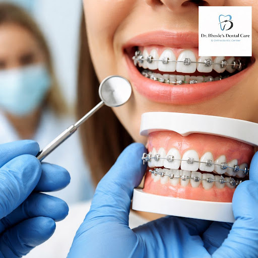 Crooked, crowded or gapped teeth can affect your smile, confidence and oral health. At Dr Bhosle'… post image