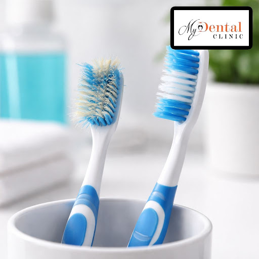 A fresh toothbrush is a small change that makes a big difference to your oral health. At My Denta… post image