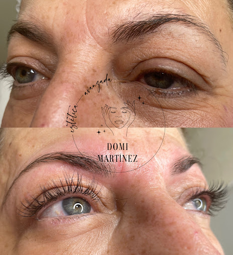 Estética Avanzada Domi Martínez Gallery - Spain