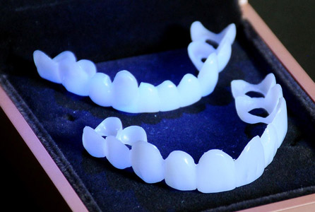 Alpha Veneers - Visual