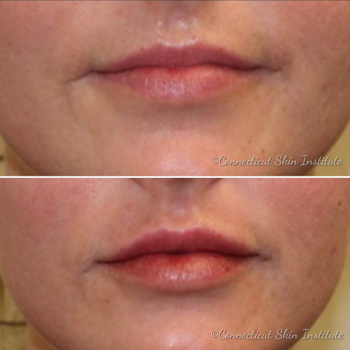 Connecticut Skin Institute