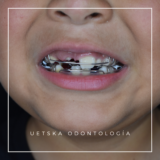 Uetska Odontología - Thumbnail
